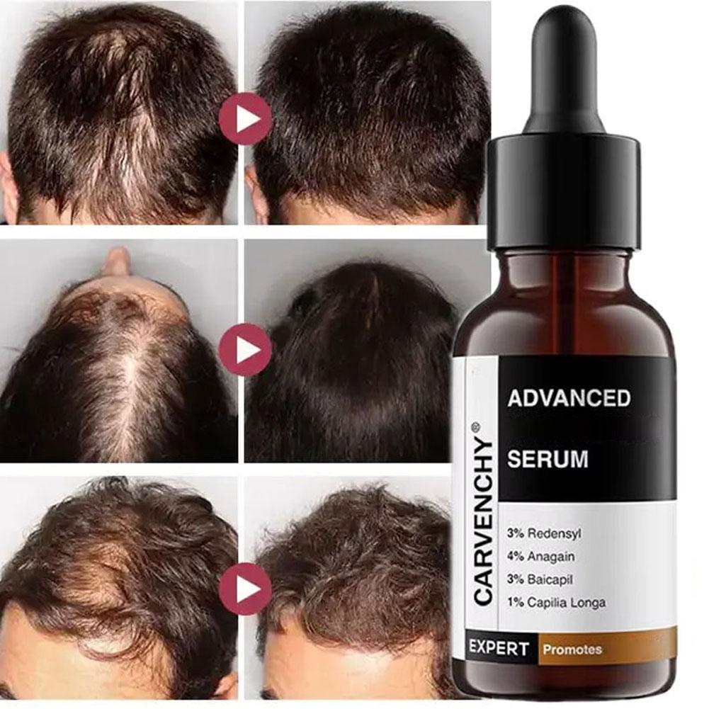 Hair Care Growth - Rosemary Essential Oil For Hair Care