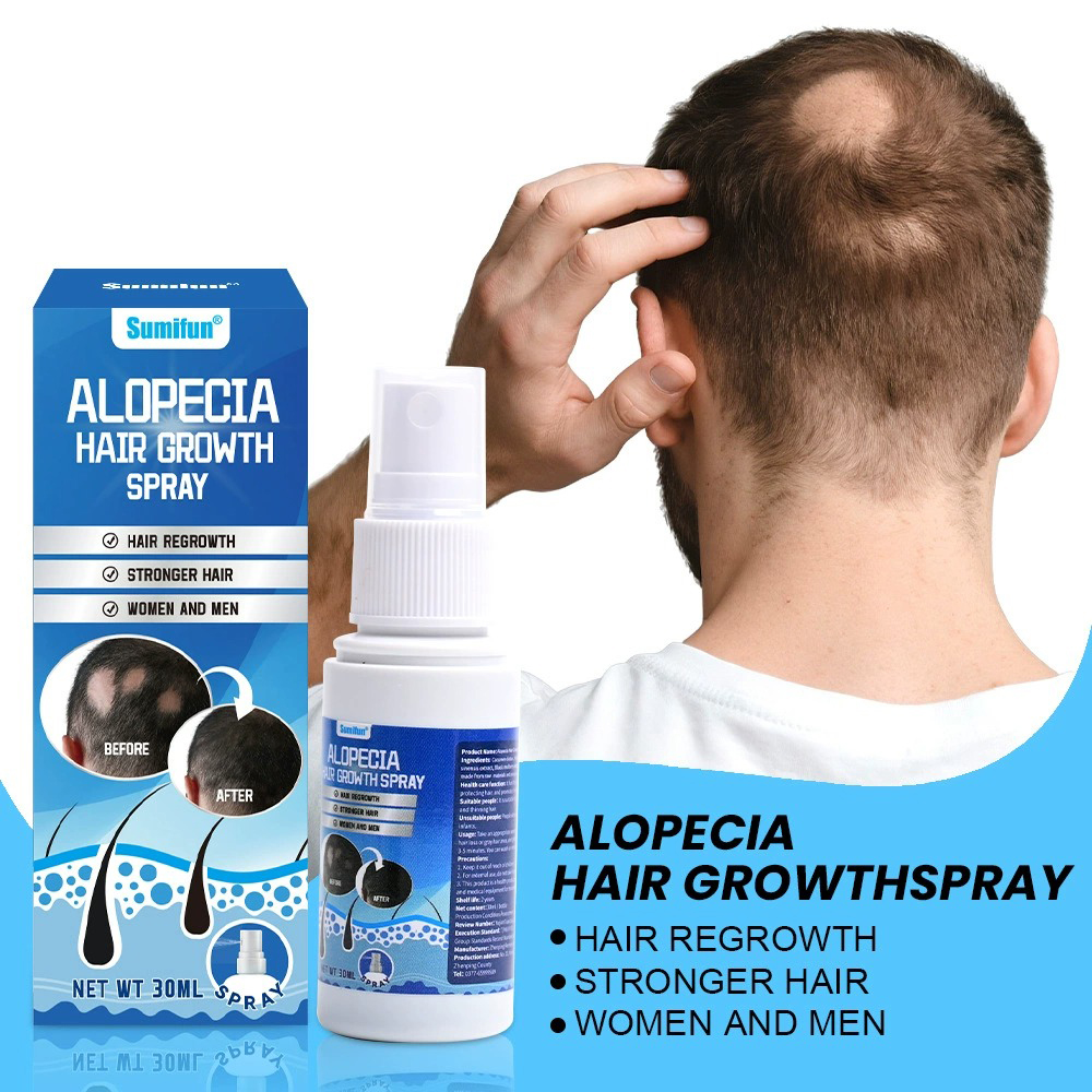 Alopecia Hair Growth Spray Sop - Hair Care Growth 评论和价格