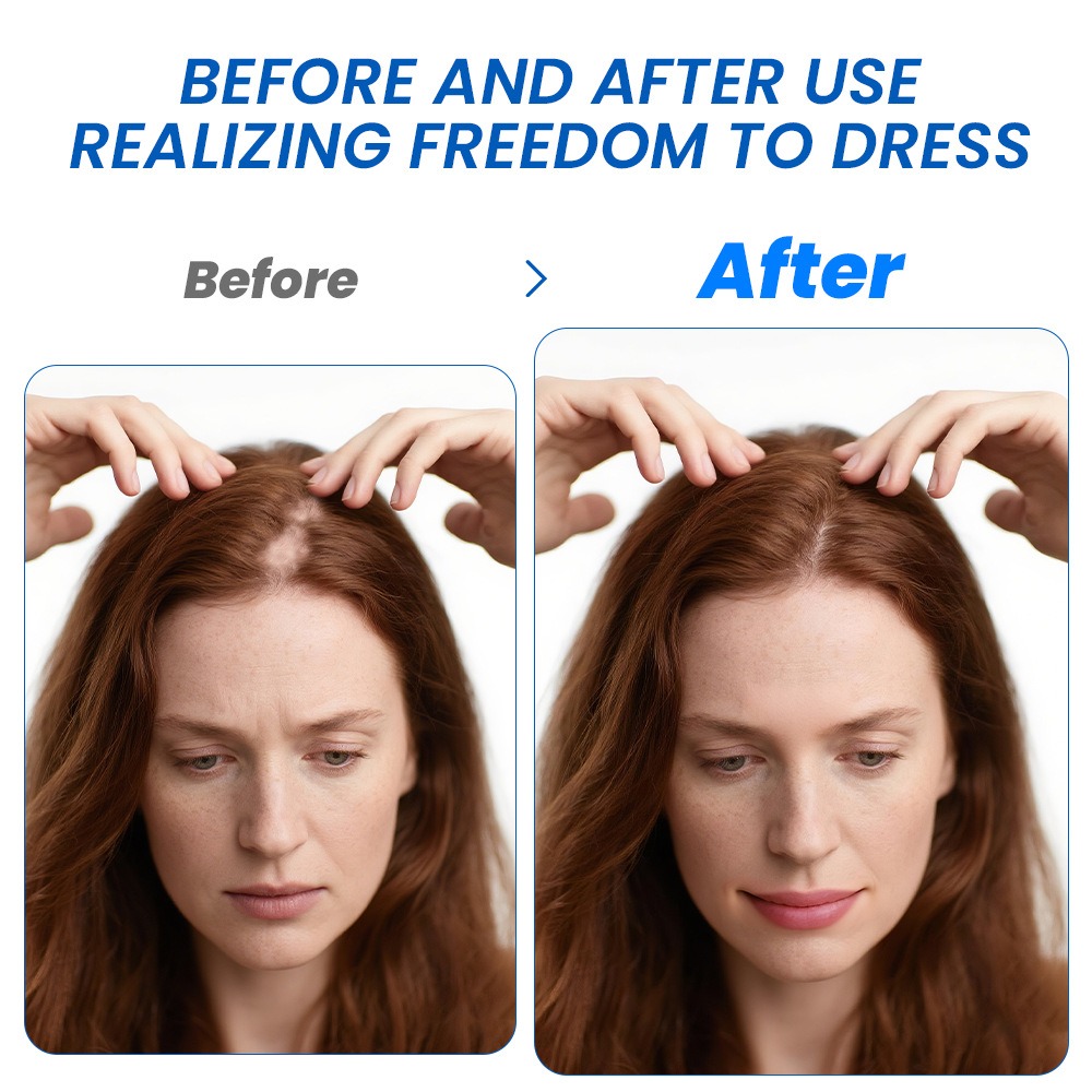 Alopecia Hair Growth Spray Sop - Hair Care Growth 评论和价格