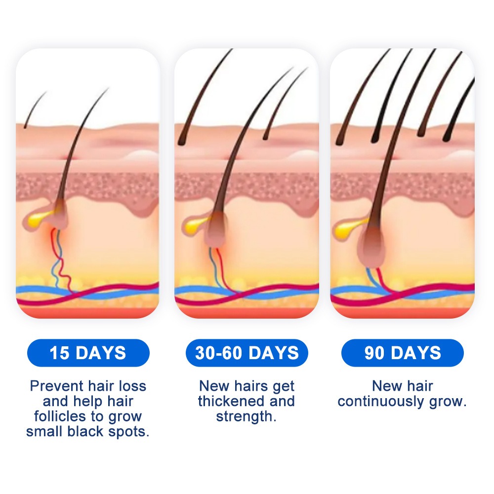 Alopecia Hair Growth Spray Sop - Hair Care Growth 评论和价格