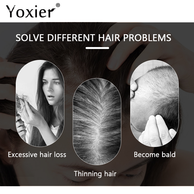 Intensive Growth Serum Prevent - Hair Care Growth 评论和价格