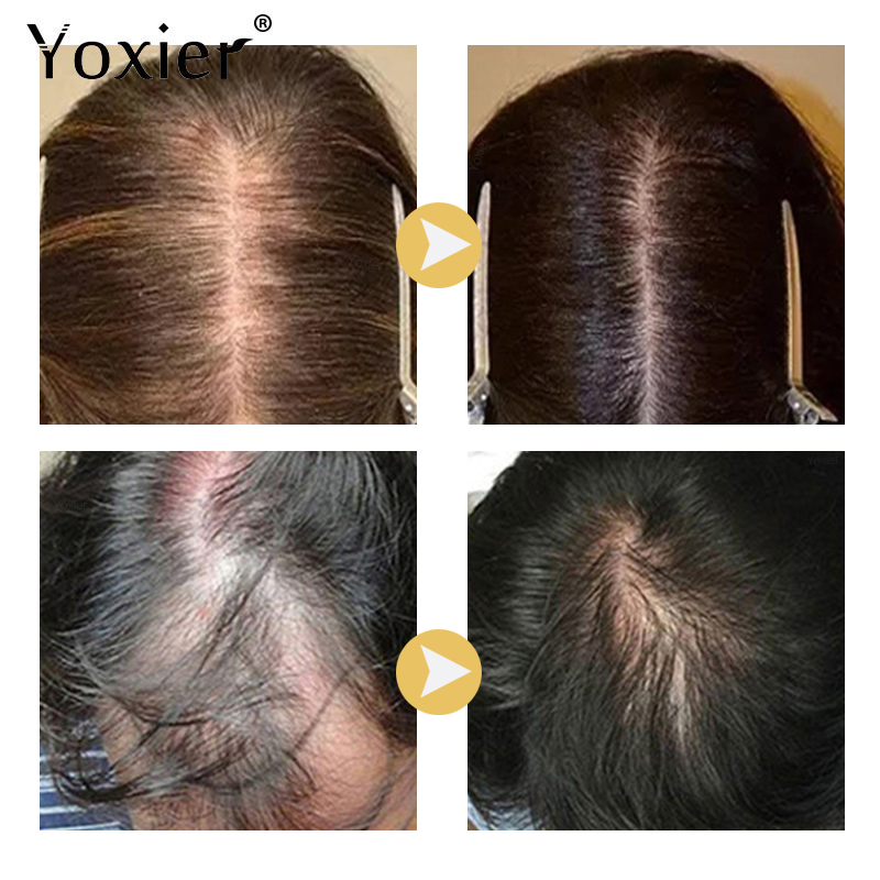 Intensive Growth Serum Prevent - Hair Care Growth 评论和价格