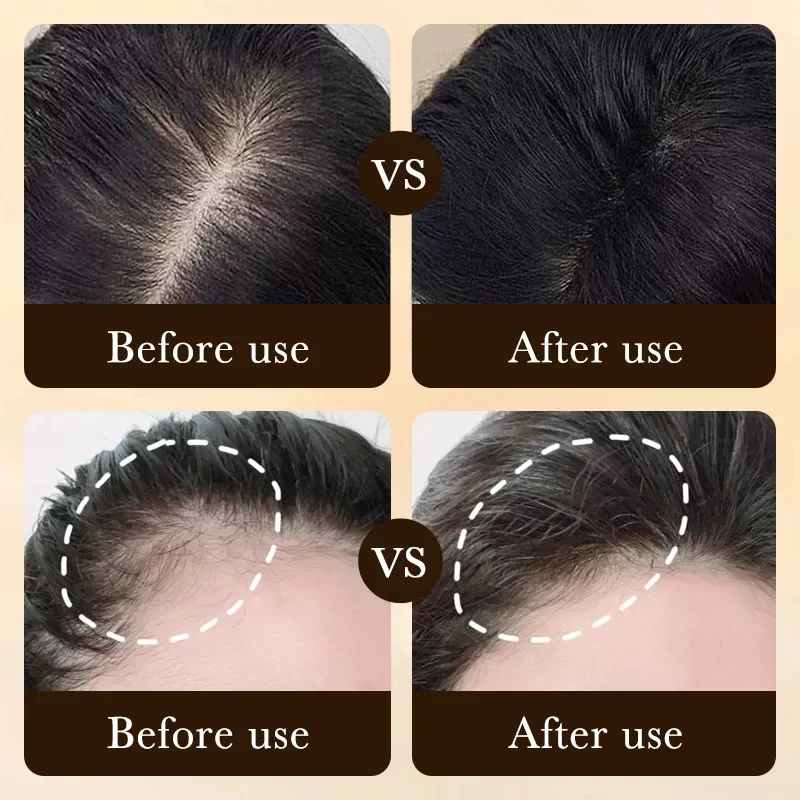 Biotin fast Hair Growth oil Pr - Hair Care Fragrance Essential Oil 评论和价格