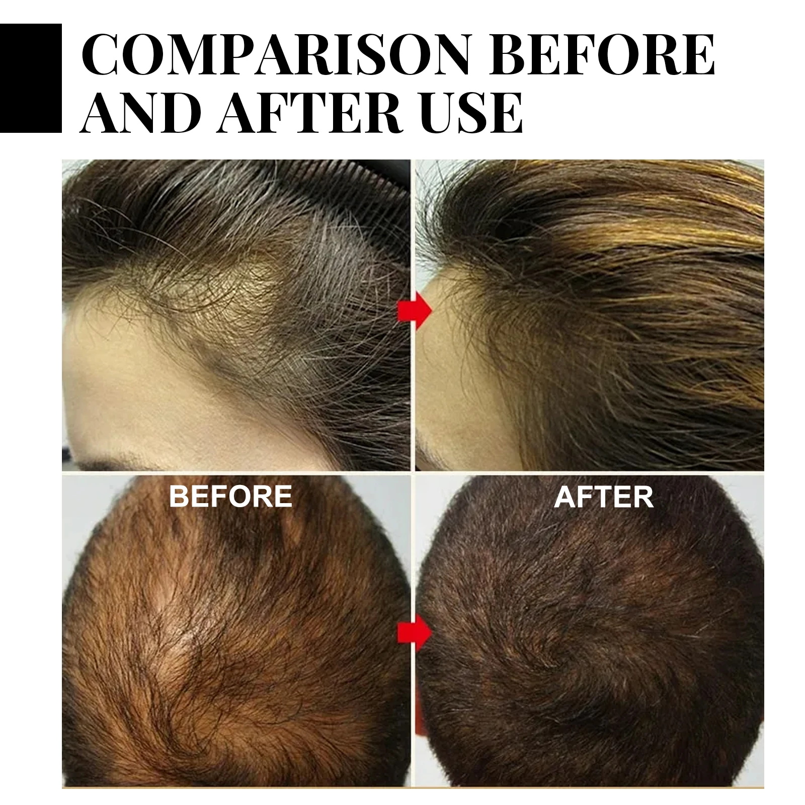 Fast Ginger Hair Growth Spray  - Hair Care Oil Serum 评论和价格
