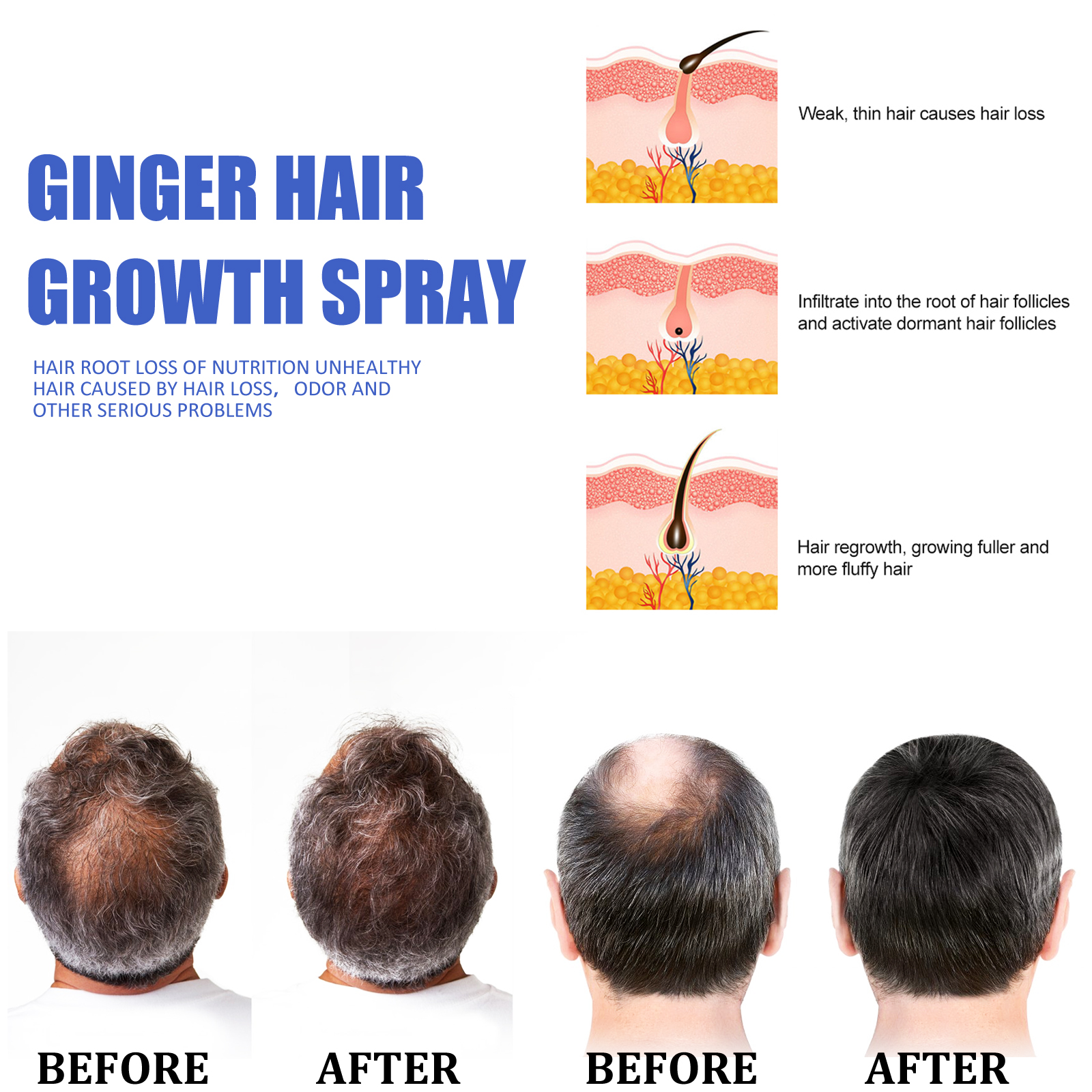 Fast Ginger Hair Growth Spray  - Hair Care Oil Serum 评论和价格