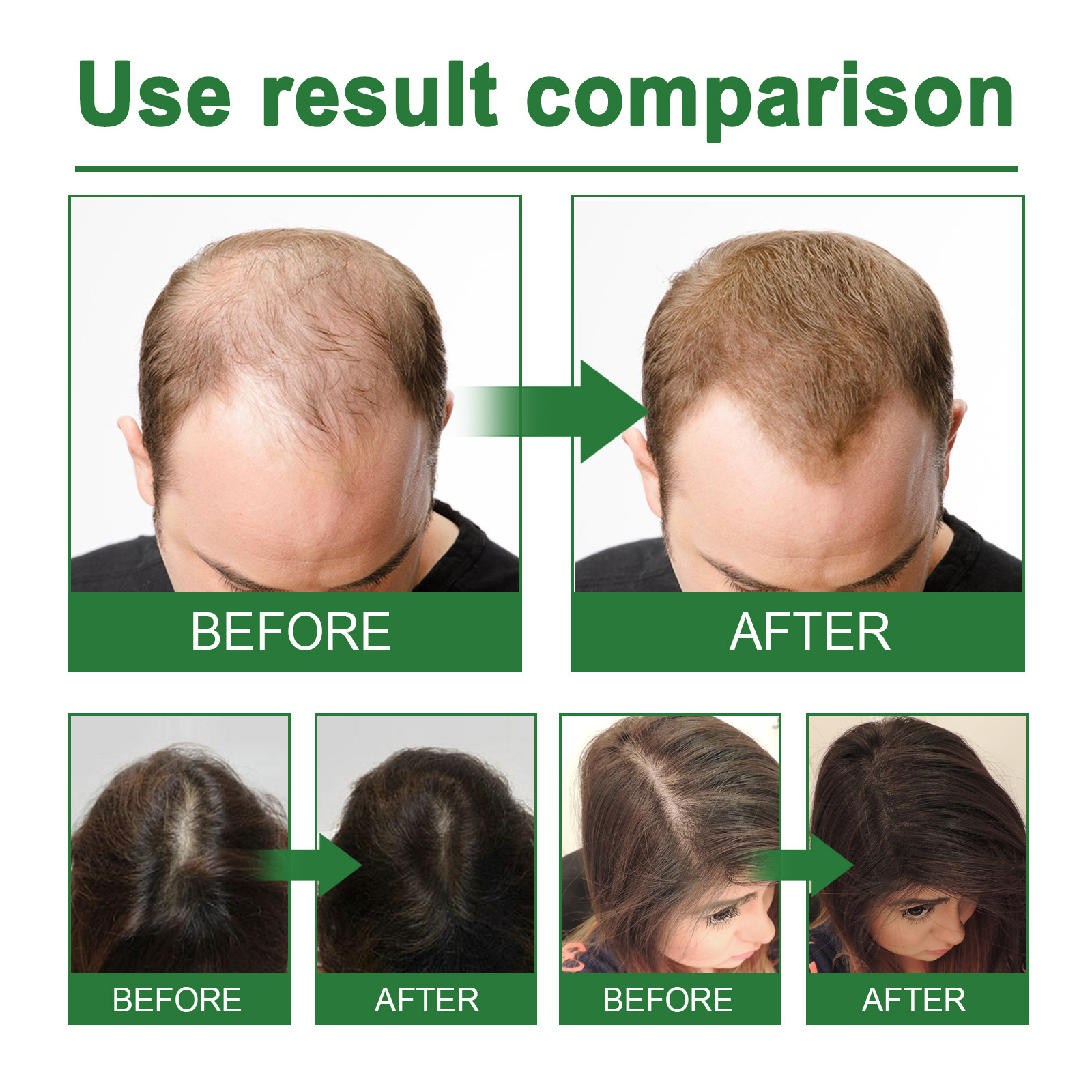 Rosemary Spray for Hair Nouris - Hair Care Growth 评论和价格