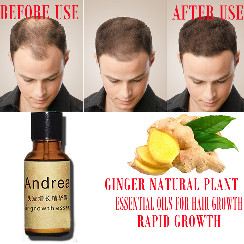 2/5/10Pcs Andrea Hair Growth S - Hair Care Fragrance Essential Oil 评论和价格