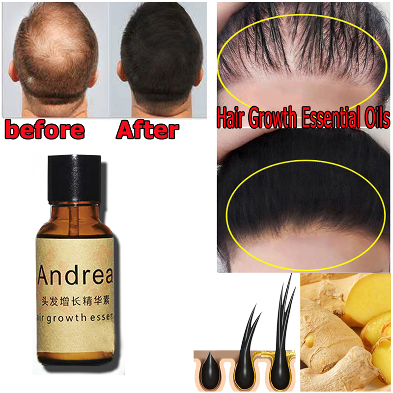 2/5/10Pcs Andrea Hair Growth S - Hair Care Fragrance Essential Oil 评论和价格