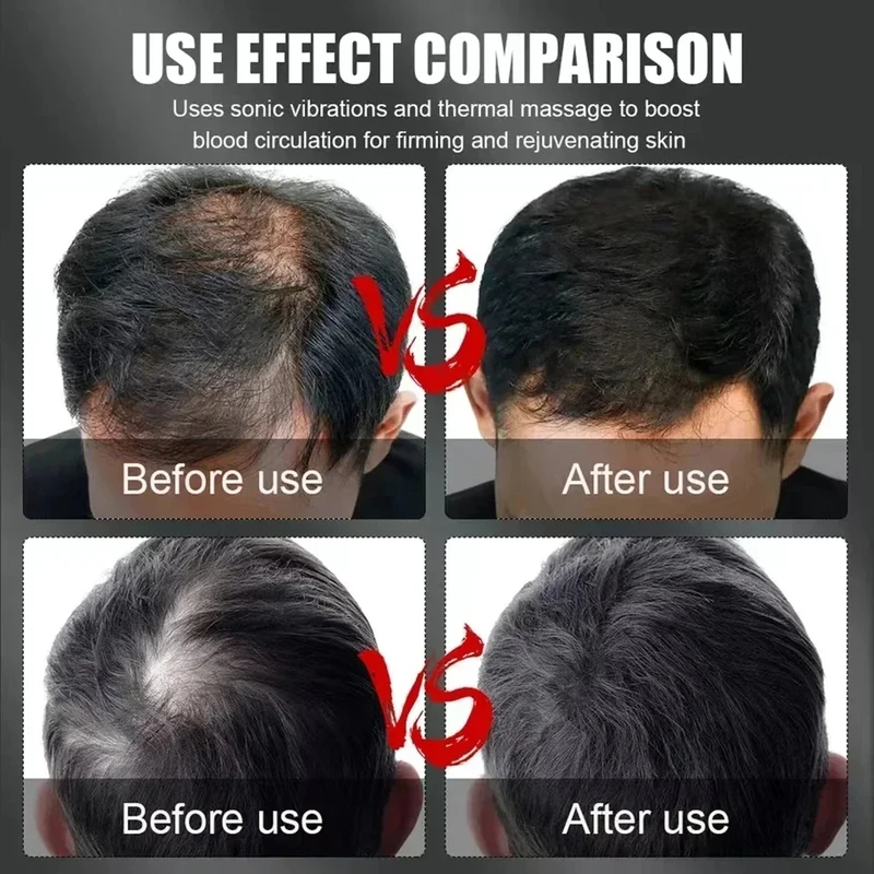 660nm 850nm Red Light Infrared - Hair Care Growth 评论和价格